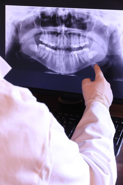 Best Emergency Root Canal Therapy in Cary, IL