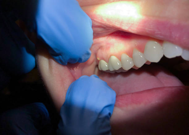 Best Emergency Treatment for Jaw Pain or Injury in Cary, IL
