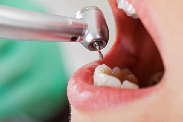 Best Emergency Orthodontic Repairs in Cary, IL